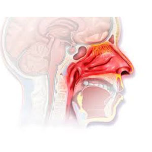 allergic_rhinutitis