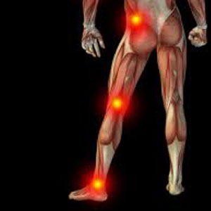 sciatica